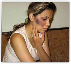 Iranian Christian beaten by police