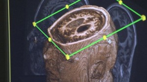 BBC brain scan