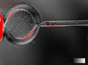 The extraction of a nucleus from an egg is one of the steps involved in cloning (Photo Baptist Press)