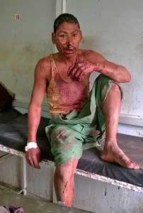 One of the victims of attack in Assam, India. (Morning Star News)