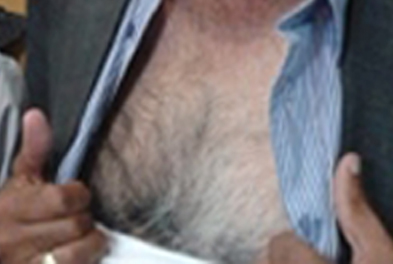 Close-up of mark on chest