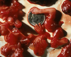 aborted baby parts
