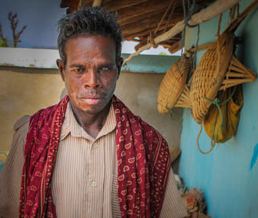 A man from the Korwa people group in Chhattisgarh state put his faith in Christ after church prayers healed him of painful sores. (Christian Aid Mission)