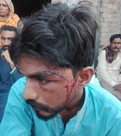 A Christian beaten in Khushal Town.