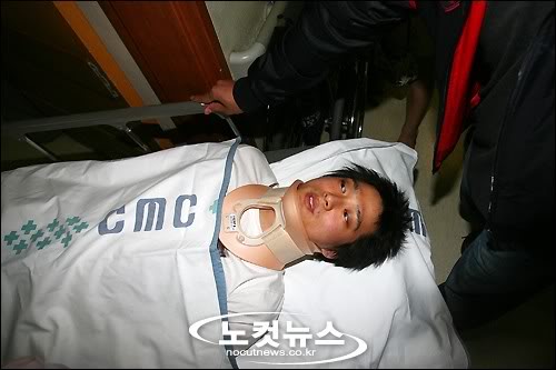 Kyuhyun after the car accident.