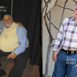 Chuck Bernal Before After