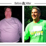 Steve Reynolds Before And After