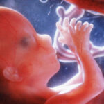 PRinc_photo_of_fetus_at_16_weeks
