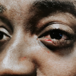 guvna b beaten by racist thugs